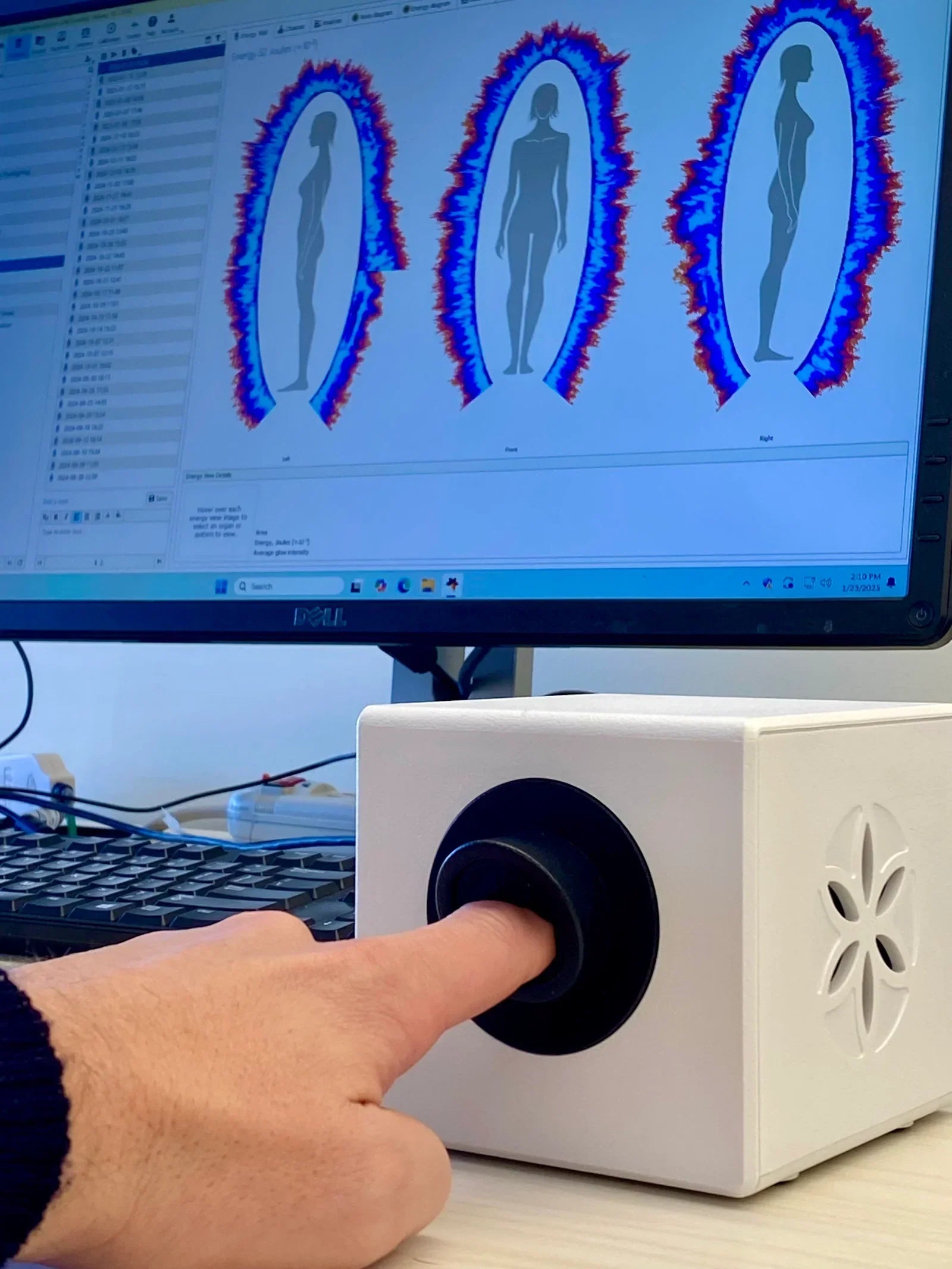 How Bio-Well detected blood sugar patterns: the diabetes study